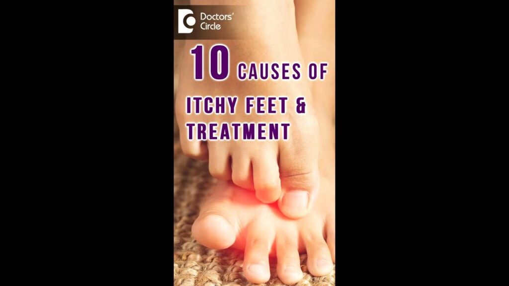 Scratching the Surface: Causes and Cures for Itchy Feet