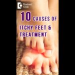 Scratching the Surface: Causes and Cures for Itchy Feet