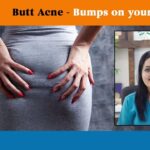 Buh-bye Butt Acne! Dr. Urmila Nischal uncovers causes & treatments