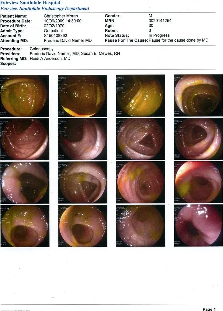 The Inside Scoop:‌ All About Colonoscopy & Gut Health