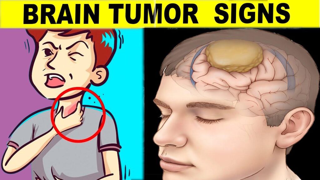 Spotting Telltale Signs of Brain Tumors: A Closer Look