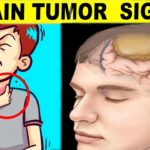 Spotting Telltale Signs of Brain Tumors: A Closer Look