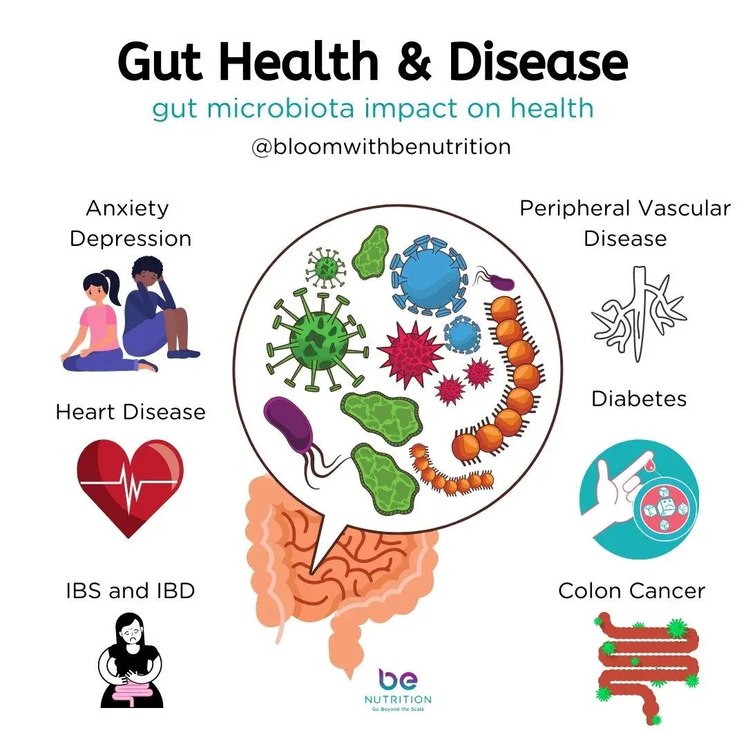 Foods to Support Gut Health: A Balanced Diet ​for Optimal⁢ Digestion