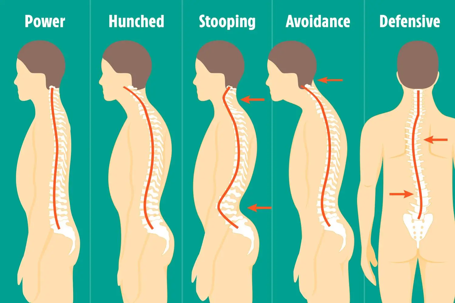 Ergonomic⁢ Tips for Correct Posture