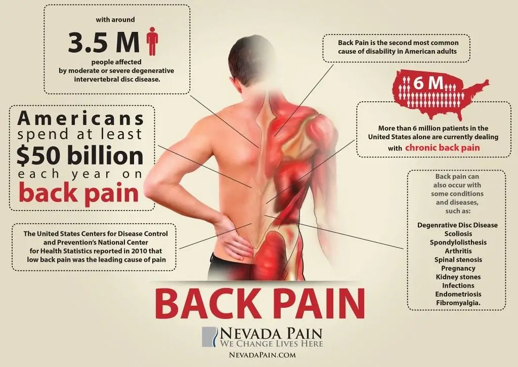 Technique Matters: Key Tips ‌for​ Performing Back Exercises ⁢Safely and Effectively